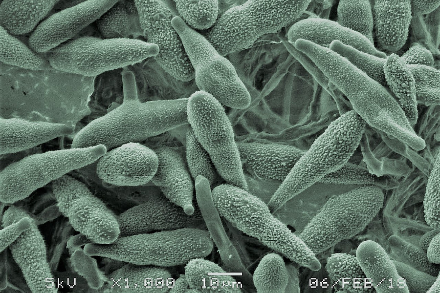 Student-generated image of mold at 1000x magnification.